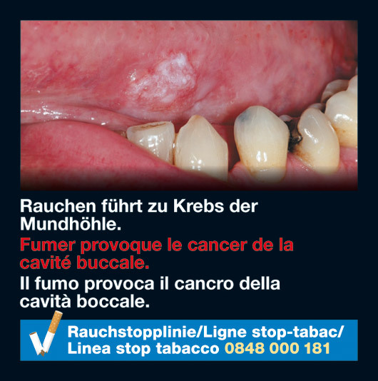 Switzerland 2010-2012 Health Effects mouth - oral cancer